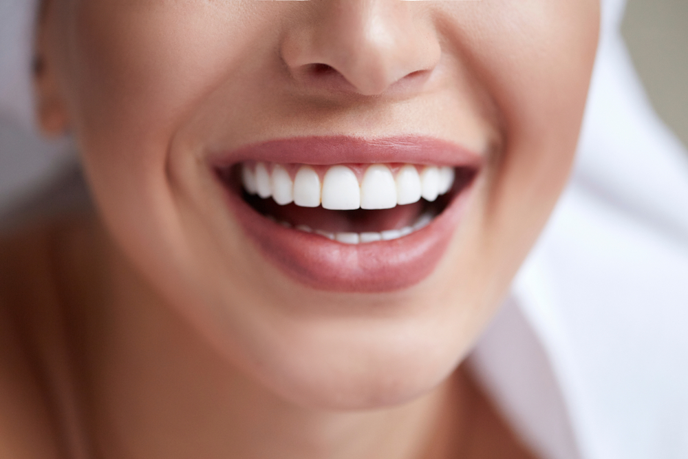 Wybielanie zębów – na czym polega i kto może to robić?